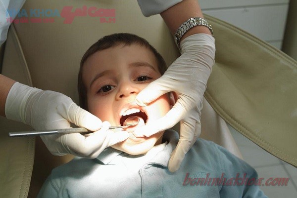 Phòng ngừa sâu răng ở trẻ