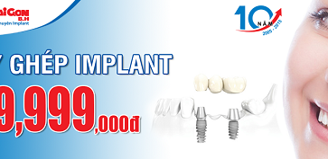 Chỉ với 9,999,000đ bạn sở hữu ngay chiếc răng implant hoàn chỉnh